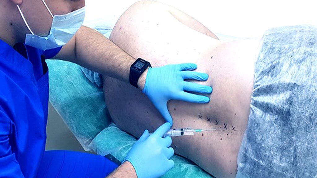Bloque espinal para osteocondrose