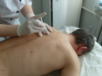 Inxeccións intraarticulares de condroprotectores para a osteocondrose torácica